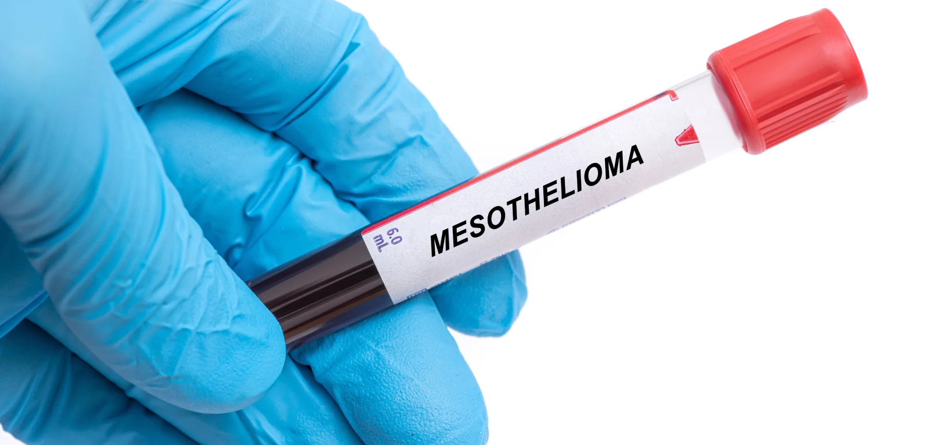 mesothelioma lawyer Los Angeles